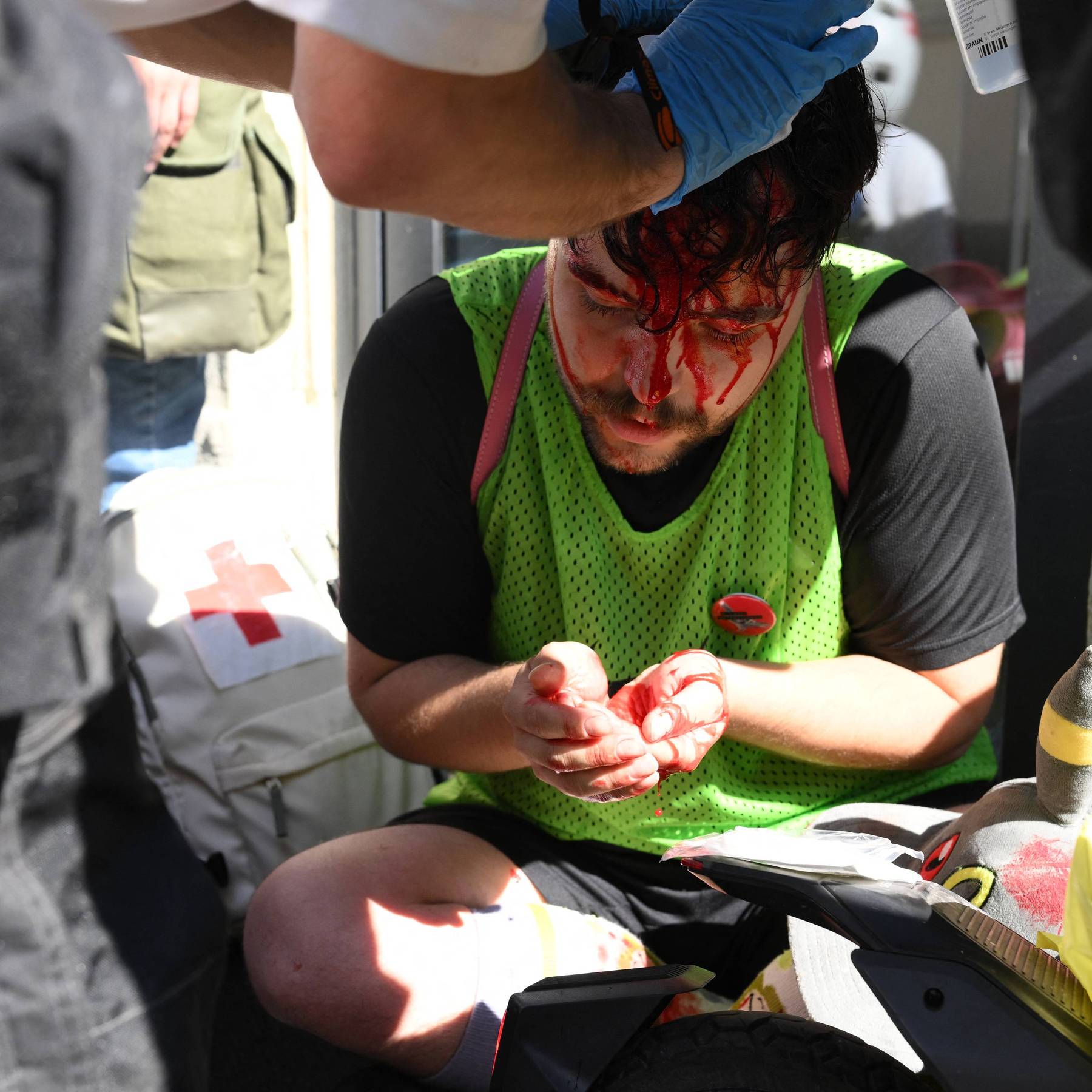 An injured protester with a bloody face receives medical care