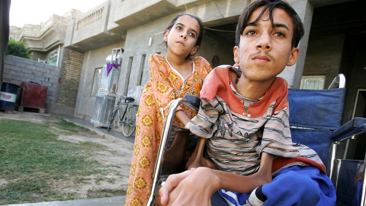 Anas Hamed (right) and his sister Inas are pictured on November 12, 2009 in Fallujah, Iraq, where birth defects have soared in the wake of the U.S. military's invasion.