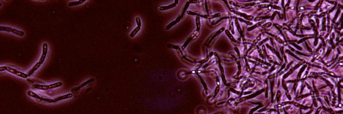 Oops: Pentagon Admits to Sending Live Anthrax Across Nation and Abroad