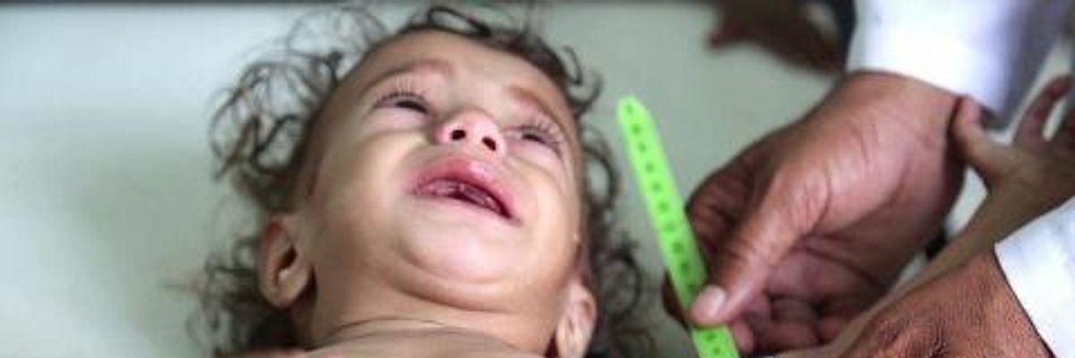 US Now Supporting Starvation on 'Unprecedented Scale' as Yemen Famine Threatens Five Million Children