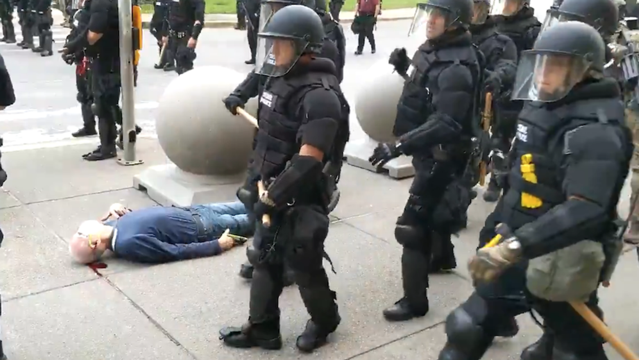 I Don't Have Qualified Immunity; Why Should Police?