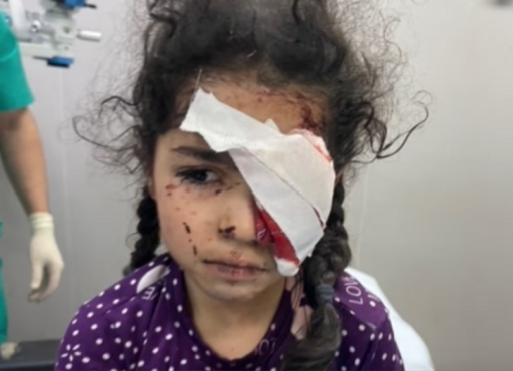 Aseel, a six-year-old Palestinian girl, being treated at Gaza's European Hospital after losing her eye in an Israeli air strike