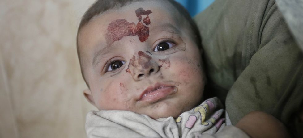 Baby injured in Israeli airstrikes is taken to Gaza's Suheda al-Aqsa Hospital