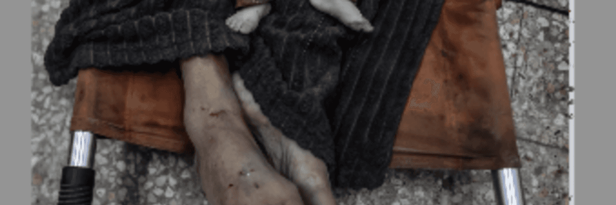 Body of dead Palestinian baby on dead Palestinian adult at Al-Aqsa Martyrs Hospital morgue