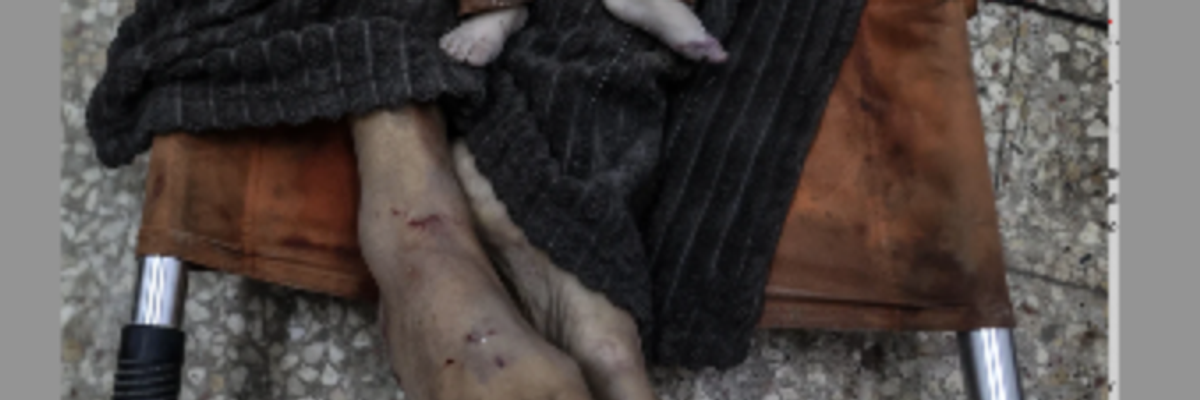 Body of dead Palestinian baby on dead Palestinian adult at Al-Aqsa Martyrs Hospital morgue