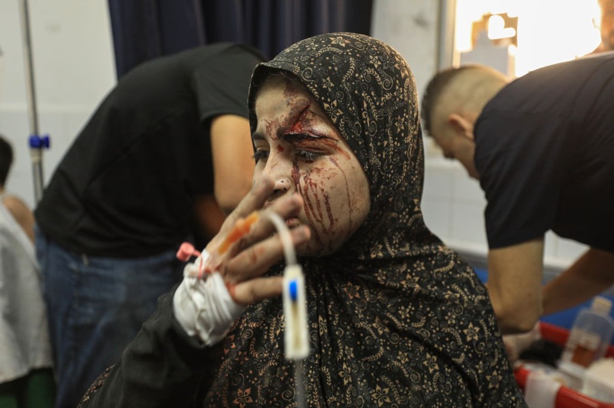 Child injured by Israel bombing of Gaza