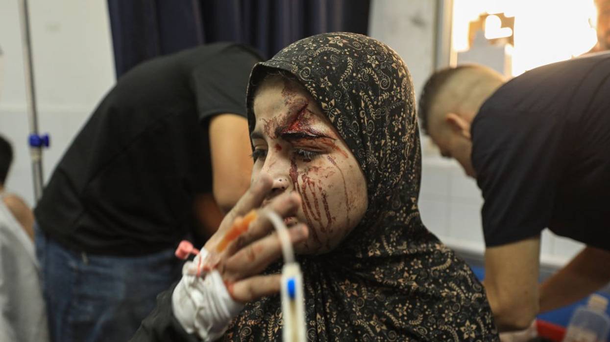Child injured by Israel bombing of Gaza