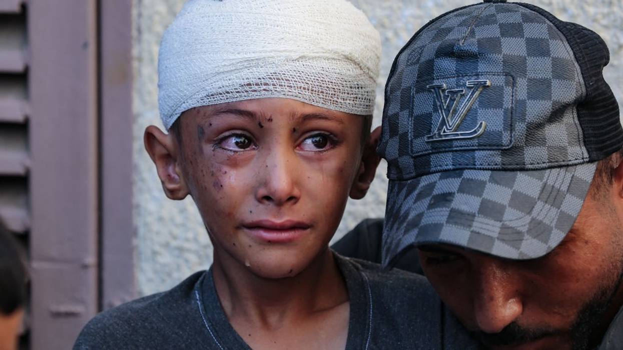Child injured in Gaza with tears