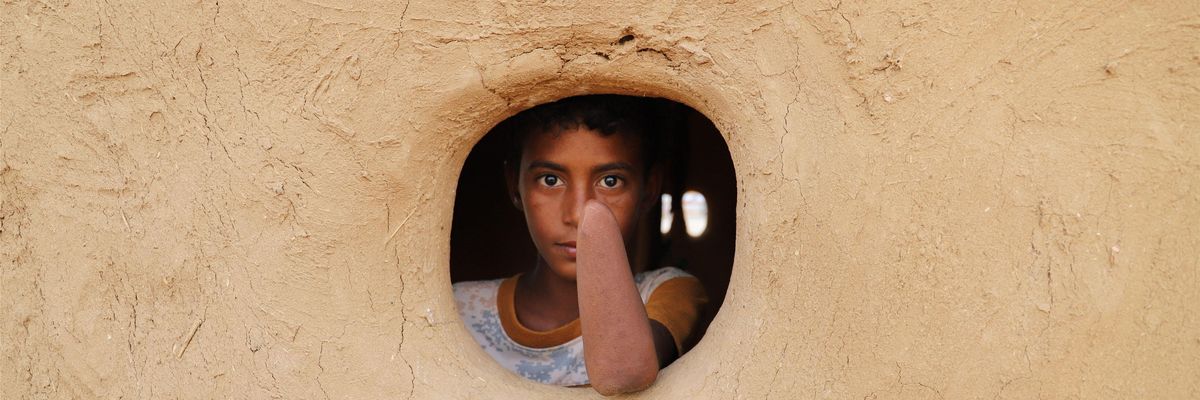 child landmine victim