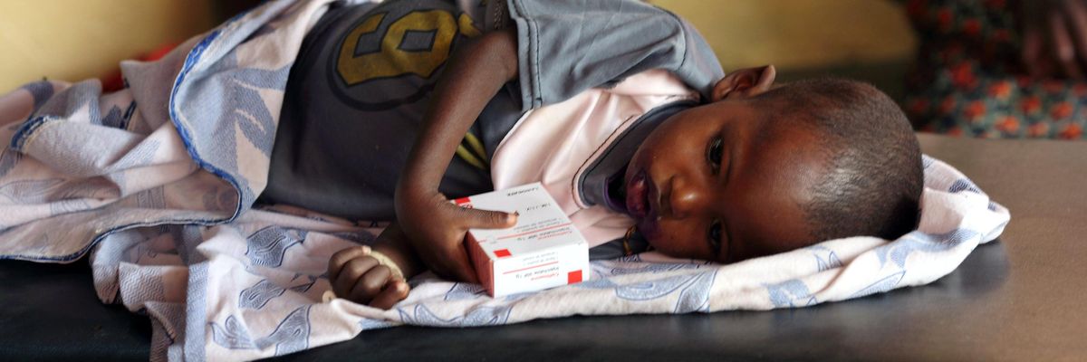 Child suffering from malnutrition