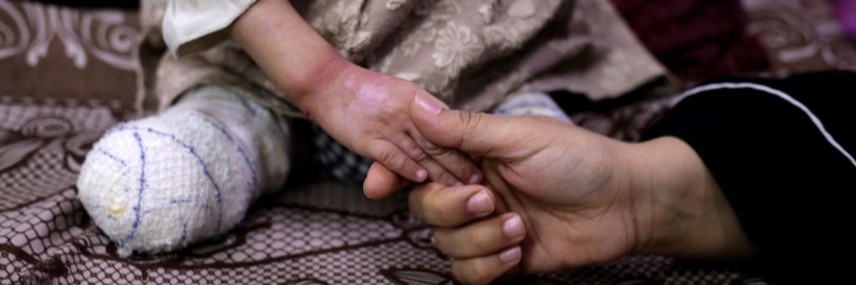 Child with amputations in Gaza.