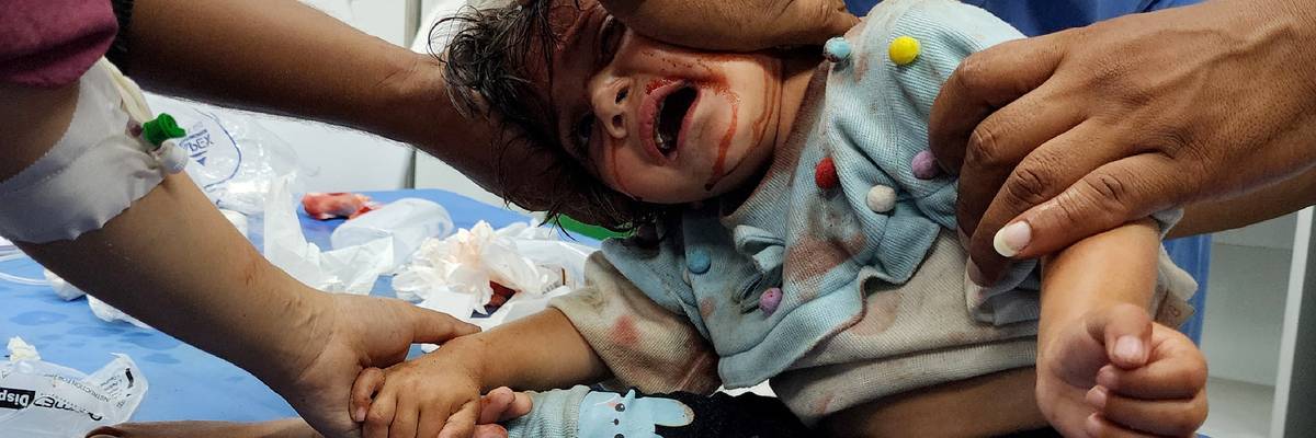 Child wounded in Gaza tents massacre.
