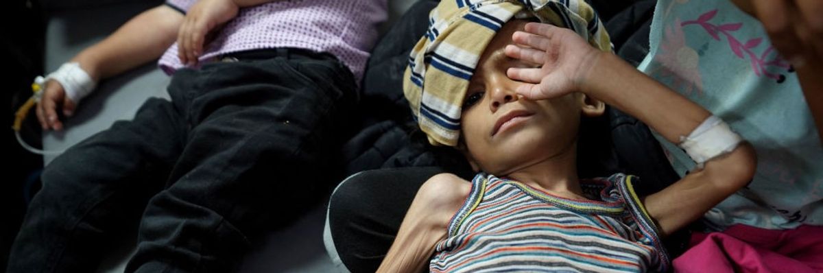 Children receive malnourishment treatment in Gaza