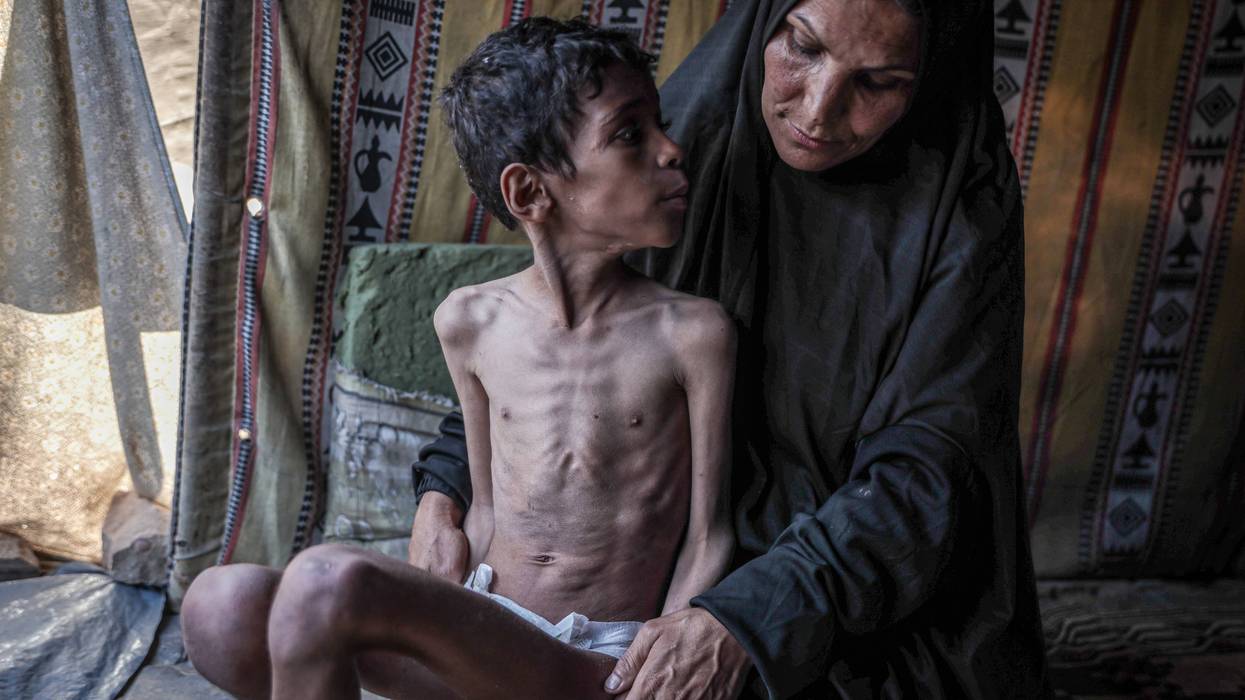 Civilians struggle with hunger in Gaza Strip as Israeli attacks continue