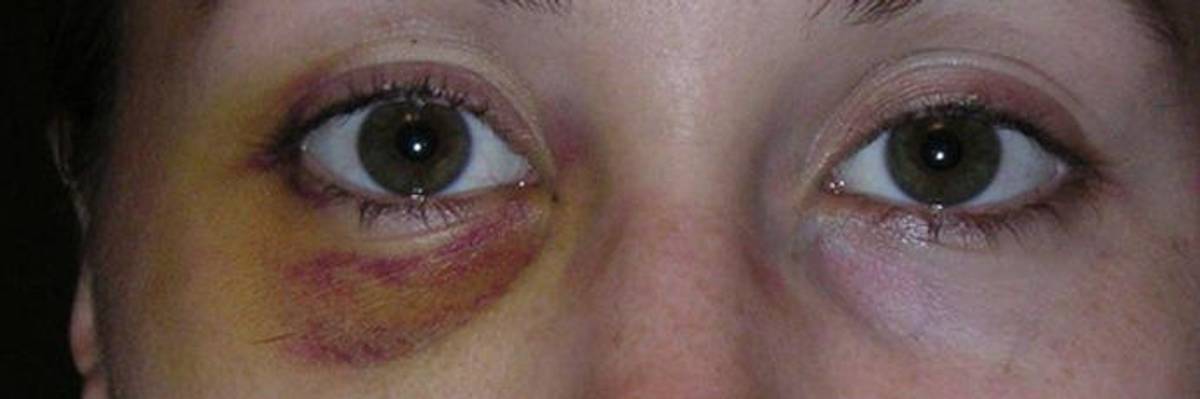 Trump Has 'Full Confidence' in Top Aide Forced to Resign After Allegations of Domestic Abuse