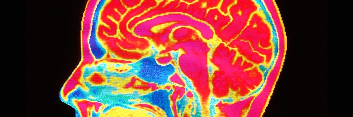 "Scariest Thing You'll Read All Day": Report Sounds Alarm Over Brain-Reading Technology and Neurocapitalism