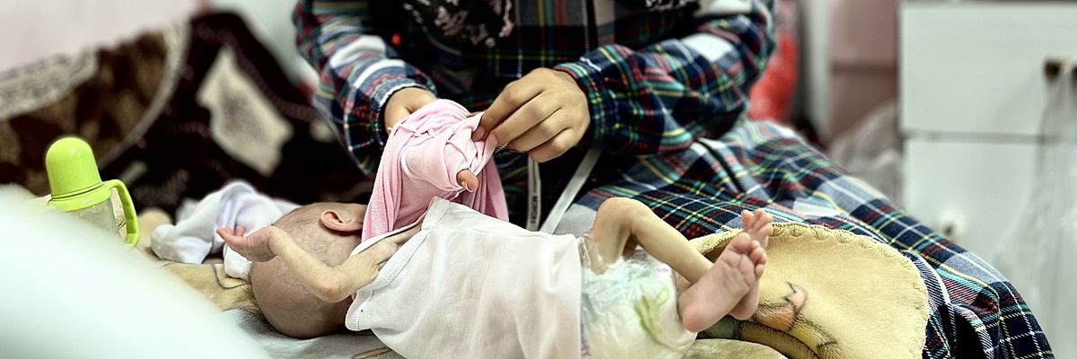 Five-month-old Suwar Ashur, one of hundreds of children diagnosed with malnutrition