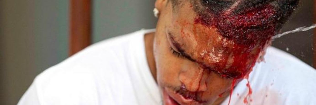 Four Arrested for Toppling Confederate Statue, But Zero Neo-Nazis Yet Arrested for This Brutal Beating