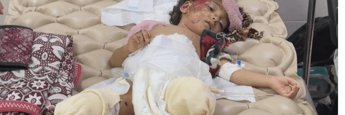 Hanan al-Daqqi, 3, had to have both legs amputated after an Israeli air strike that also killed her mother.
