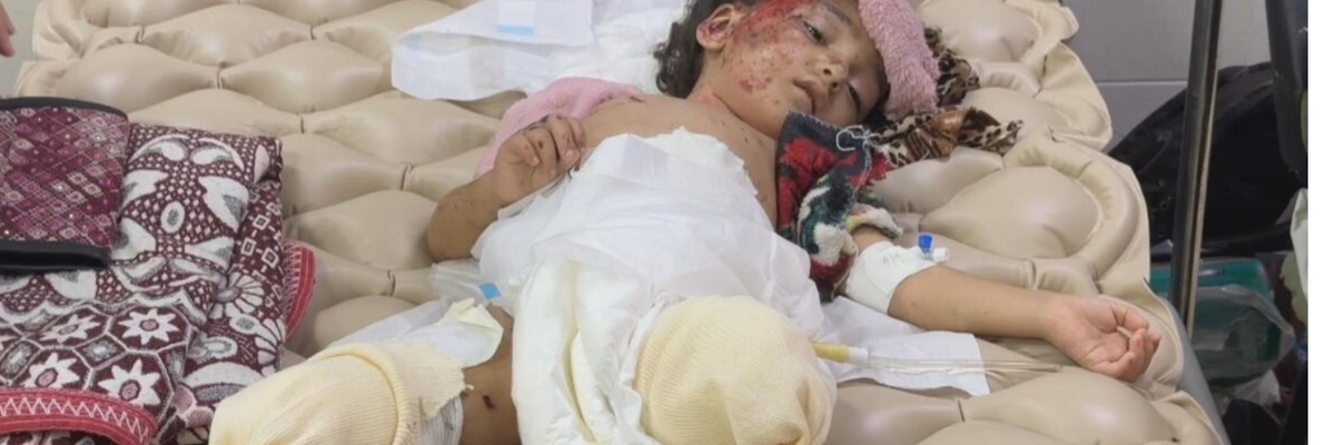 Hanan al-Daqqi, 3, had to have both legs amputated after an Israeli air strike that also killed her mother.