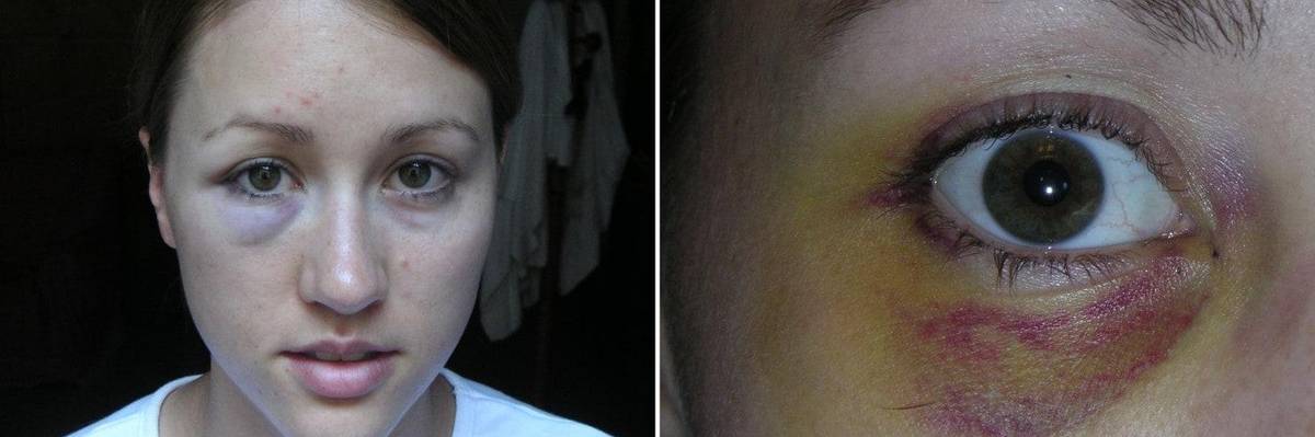 Rob Porter Is My Ex-Husband. Here's What You Should Know About Abuse.