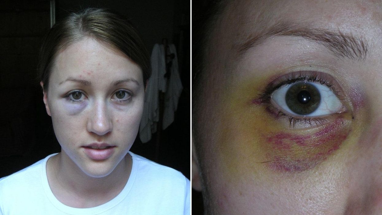 Rob Porter Is My Ex-Husband. Here's What You Should Know About Abuse.