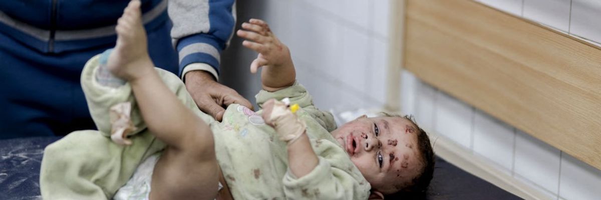 injured child in gaza