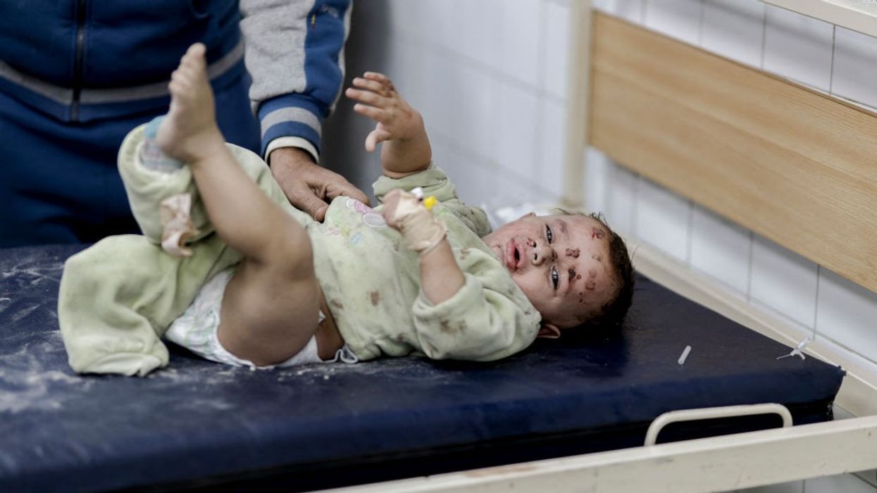injured child in gaza