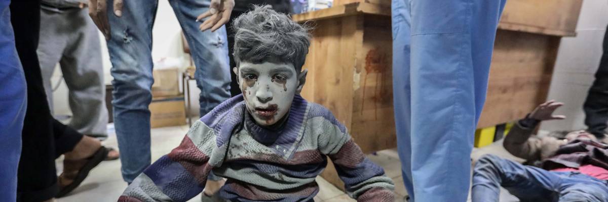 Injured Palestinian child