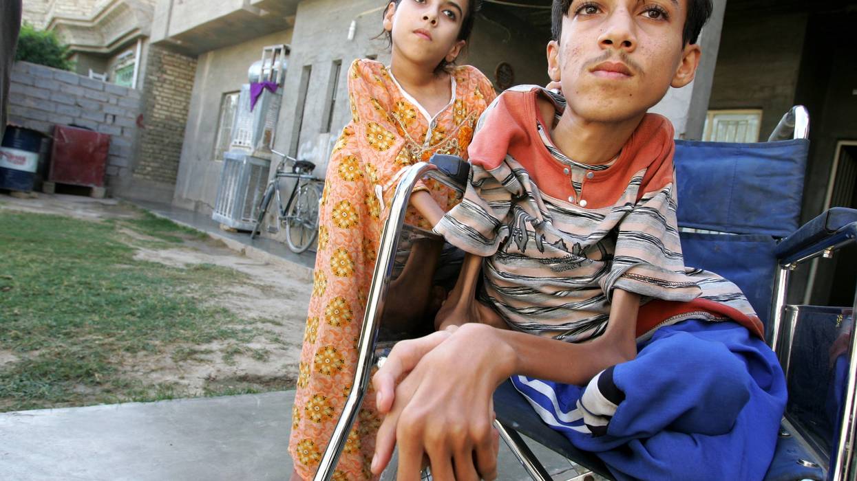Iraqi Doctors See A Huge Growth In Children Born With Deformities