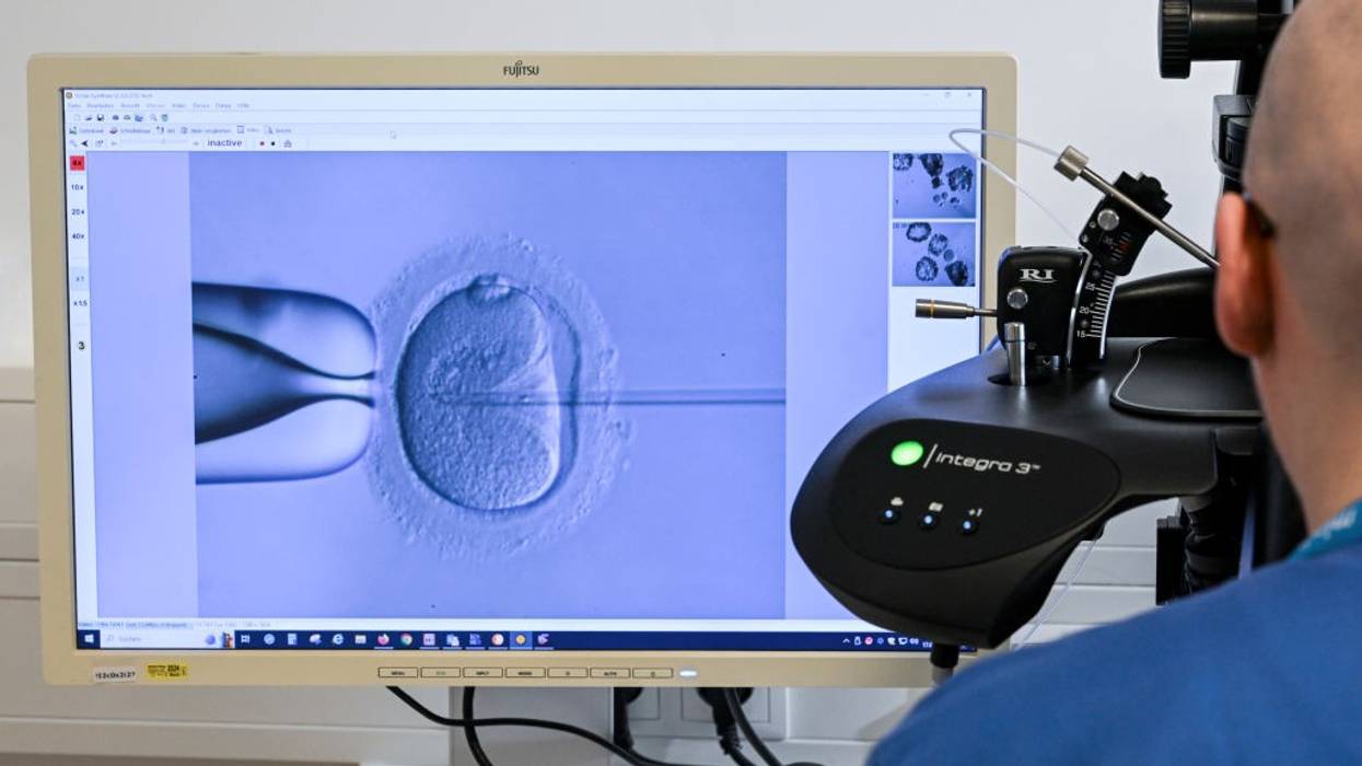 IVF