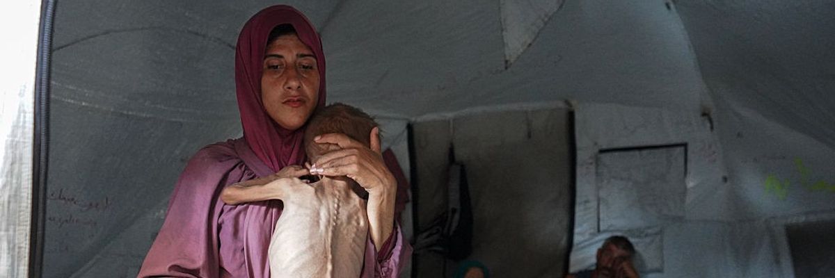 Malnourished Palestinian toddler becomes symbol of Gaza's humanitarian crisis amid Israeli blockade