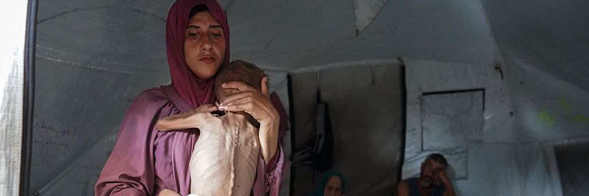 Malnourished Palestinian toddler held by his mother