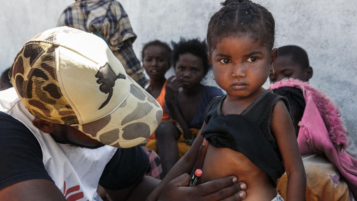 malnutrition-3600x1885