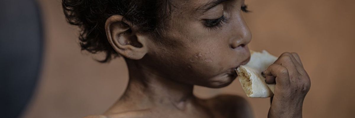 Malnutrition crisis deepens for children in Gaza under Israeli blockade