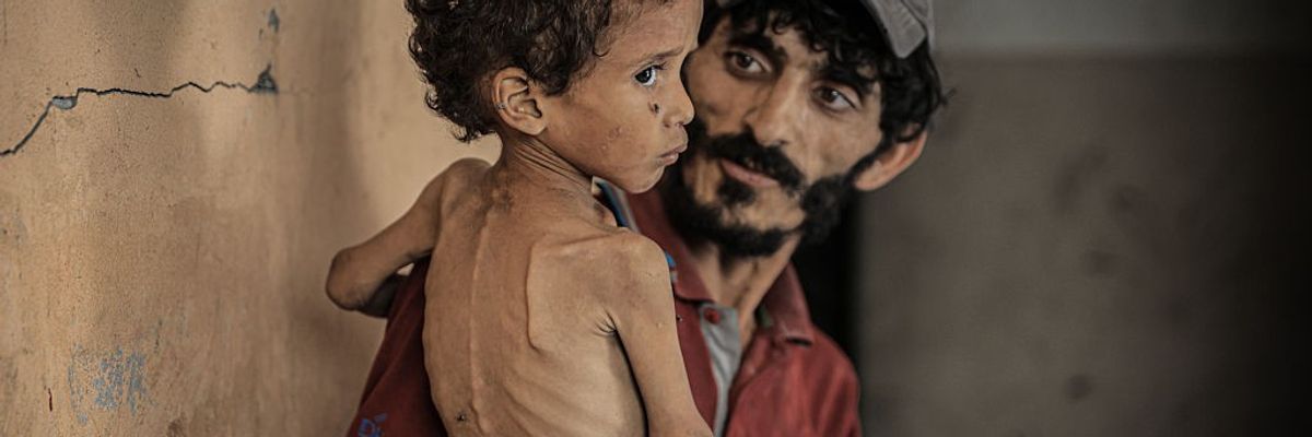 Malnutrition crisis deepens for children in Gaza under Israeli blockade