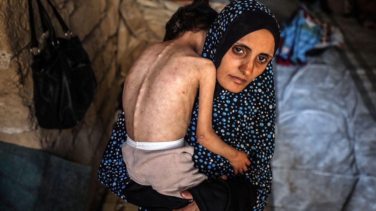Malnutrition Emergency In Gaza