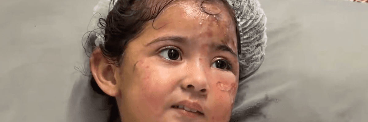 Maryam Ghanem is treated for burns