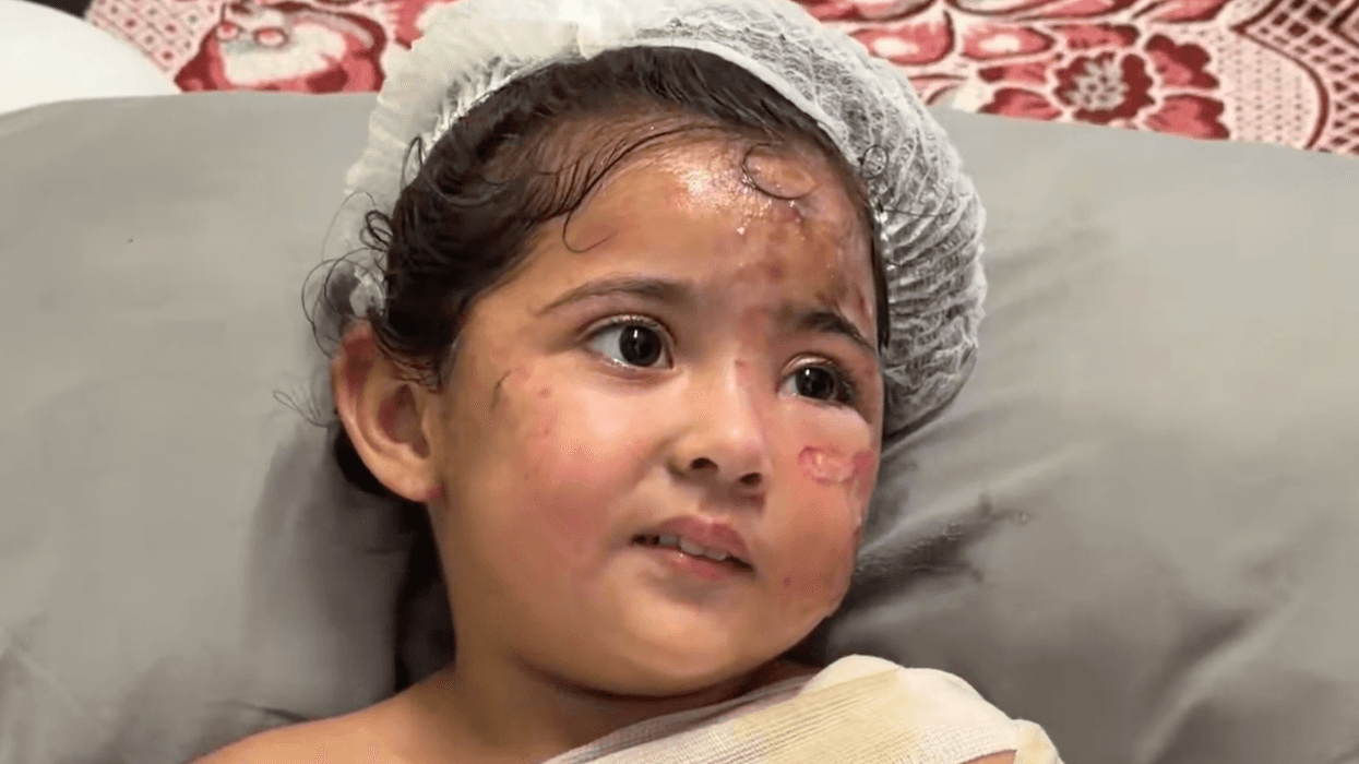 Maryam Ghanem is treated for burns