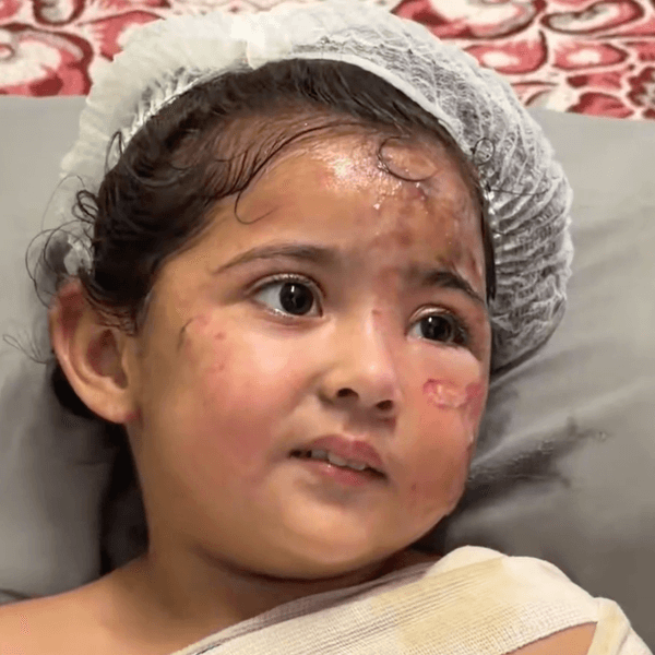Maryam Ghanem is treated for burns