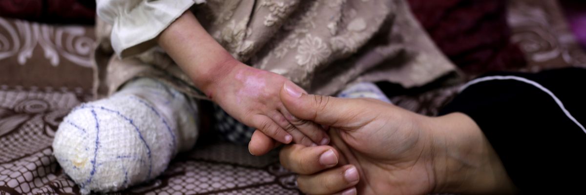 MIDEAST-GAZA-DEIR AL-BALAH-CHILD AMPUTEES