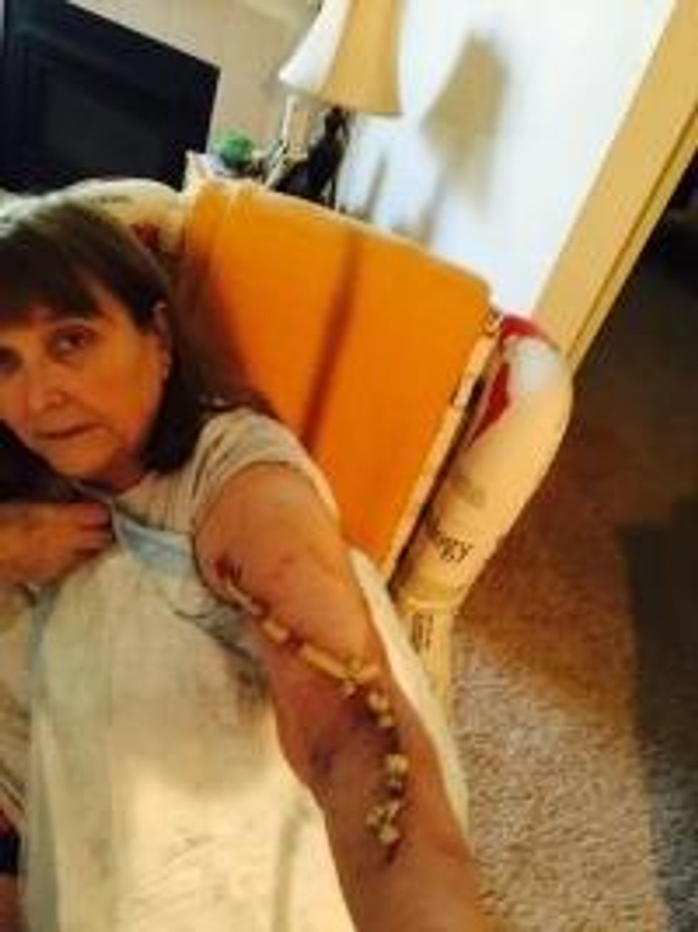 My MRSA surgical arm