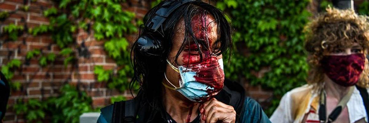 'These Are the Actions of a Fascist': Press, Rights Advocates Warn of Dangerous Pattern as Trump Again Lauds Violence Against Journalists