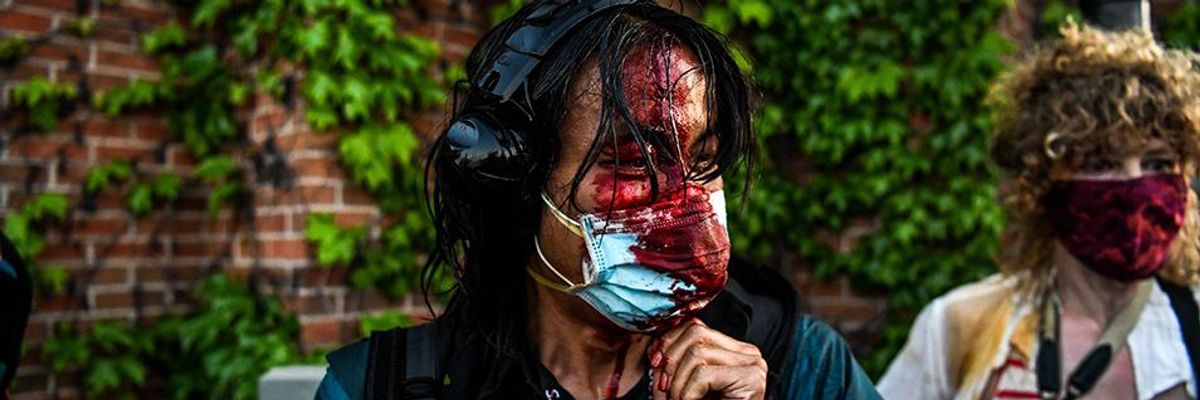 'These Are the Actions of a Fascist': Press, Rights Advocates Warn of Dangerous Pattern as Trump Again Lauds Violence Against Journalists