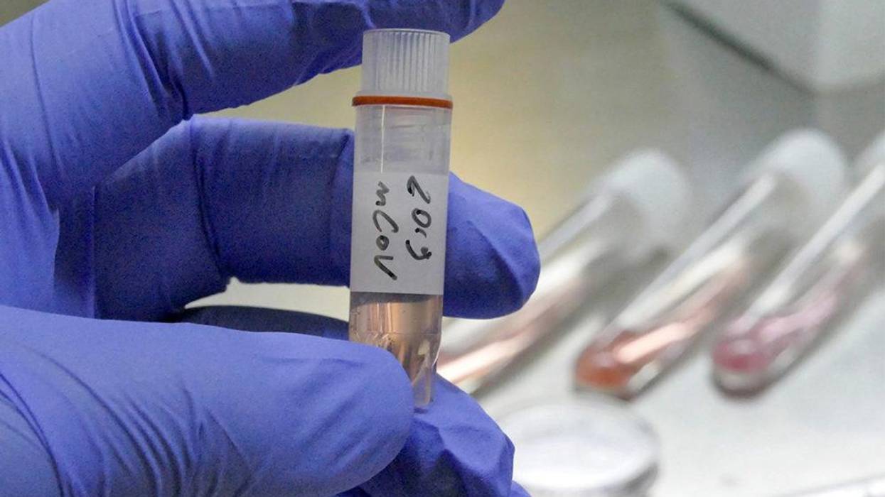 What You Need to Know About the Coronavirus Outbreak: A Civil Liberties Perspective