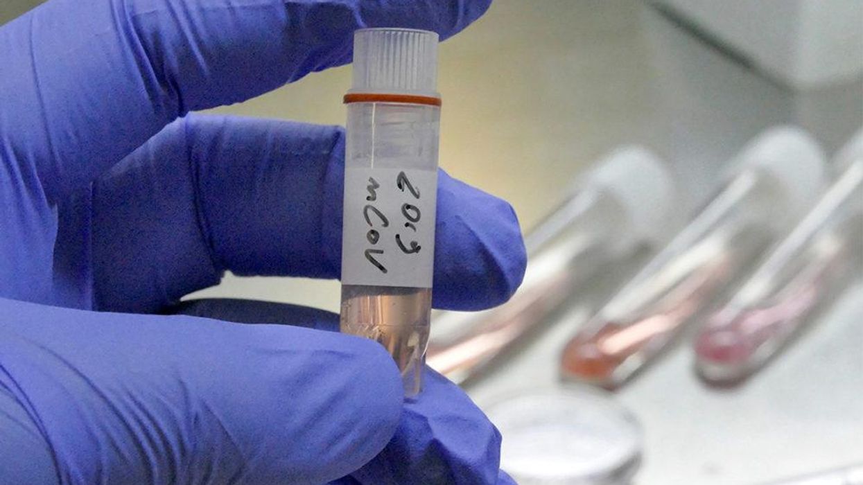 What You Need to Know About the Coronavirus Outbreak: A Civil Liberties Perspective