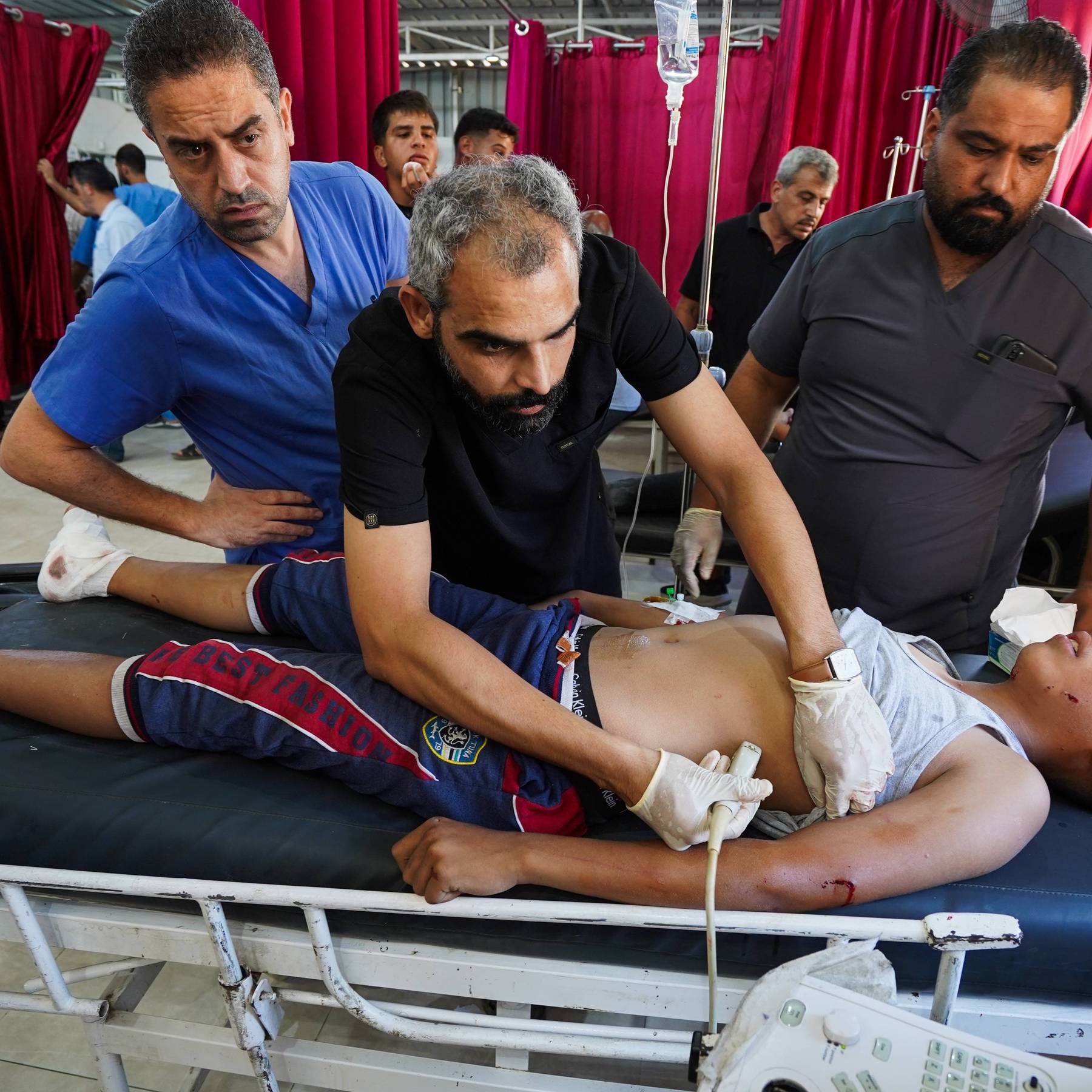 Palestinian boy receives treatment after the Israeli forces attacked the Nuseirat refugee camp