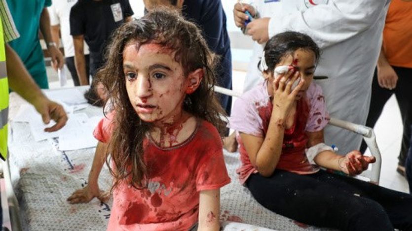 Palestinian children bloodied by Israeli air strikes in Gaza's Al-Shifa Hospital in Gaza City