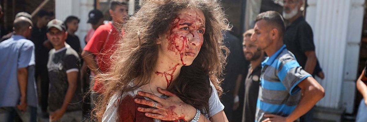 Palestinian Journalist Bayan Abu Sultan is seen after being wounded by an Israeli bombing