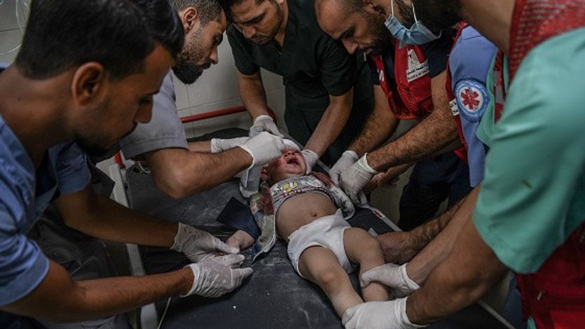 Palestinians attend injured baby in Al-Nasir Hospital in Khan Yunis, Gaza